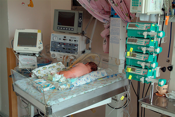 Спасение жизни новорожденных